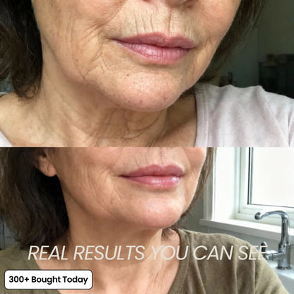 Korean Pink Collagen Volume Multi Balm | LAST DAY Buy 1 Get 1 Free